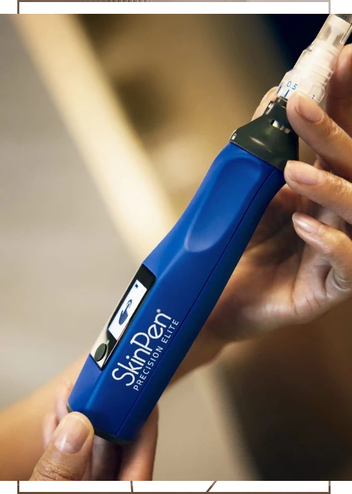 skinpen-kollagenindukcios-arckezeles SkinPen® mikrotűs készülékkel végzett arckezelés a bőr természetes kollagéntermelésének serkentésére